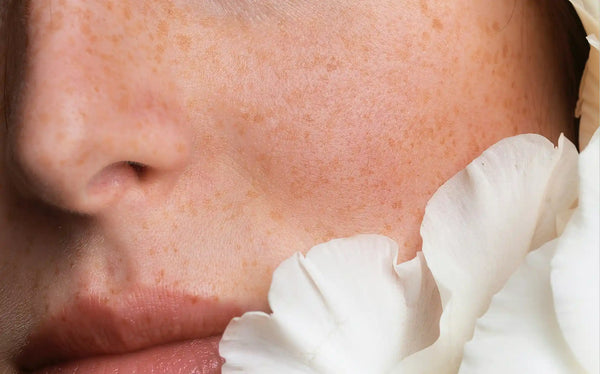 Ceramides in Skincare: What They Are & How They Work