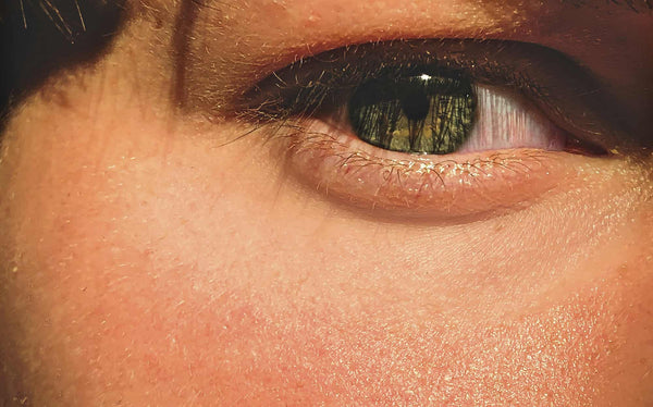 HOW TO RESTORE RADIANCE TO DULL SKIN