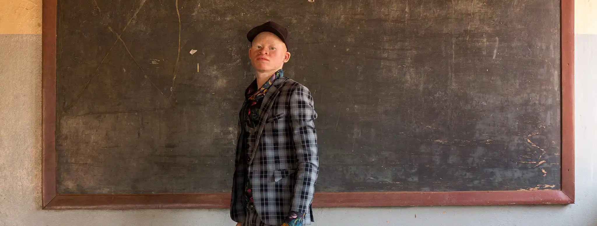 albino áfrica frente pizarra