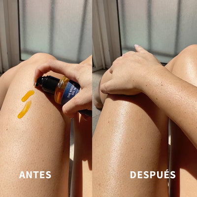 /ES/ antes y después del uso del aceite corporal de UMOA Cosmetics